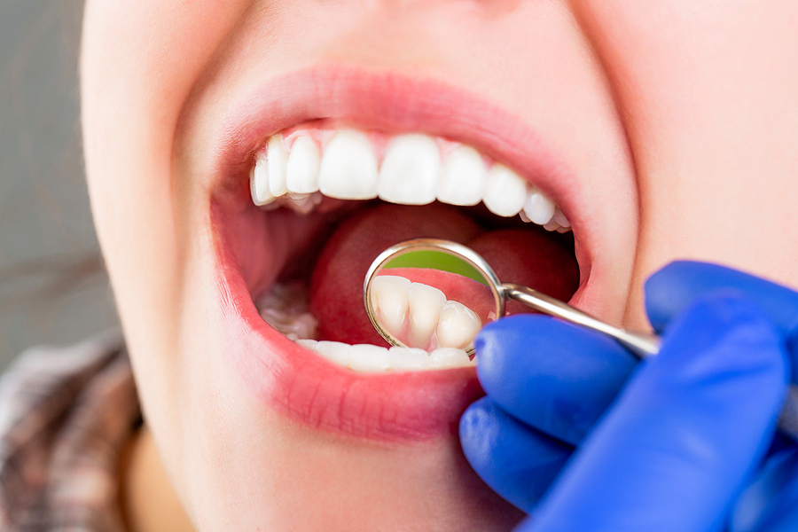 Comprehensive General Dentistry Services in Houston, TX for a Healthy Smile
